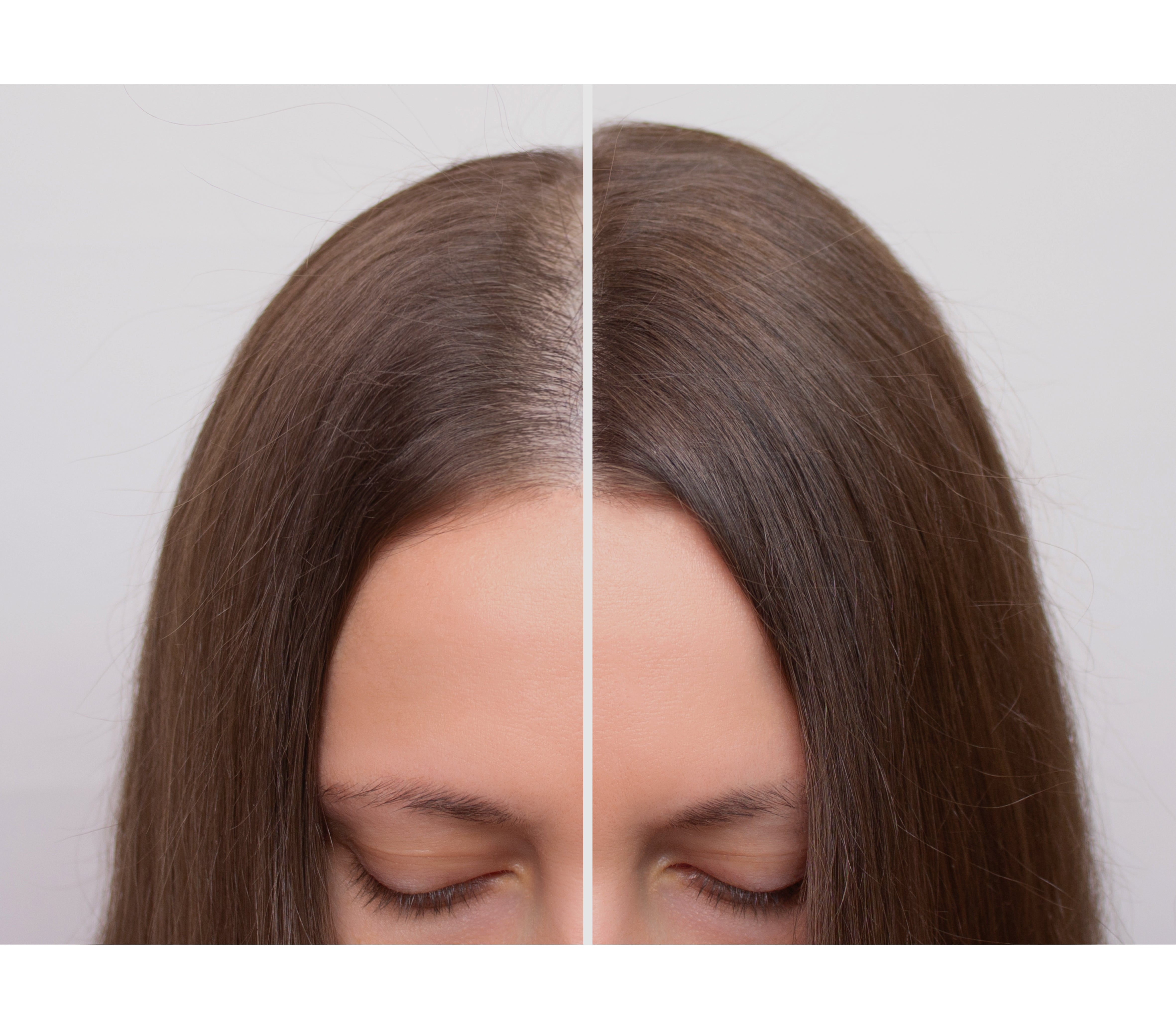 Bioactive Hair Treatment - Action Shampoo